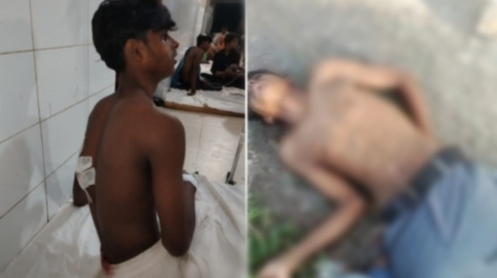 নোয়াখালী'র কোম্পানীগঞ্জে কিশোরীকে উত্ত্যক্তের প্রতিবাদ, ছুরিকাঘাতে দুই তরুণ আহত